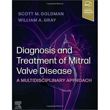 Diagnosis and Treatment of Mitral Valve Disease A Multidisciplinary Approach