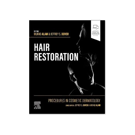 Procedures in Cosmetic Dermatology: Hair Restoration