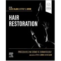 Procedures in Cosmetic Dermatology: Hair Restoration