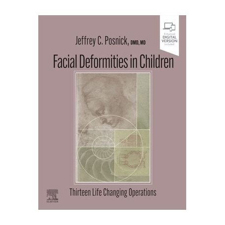 Facial Deformities in Children Thirteen Life Changing Operations