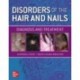 Disorders of the Hair and Nail: Diagnosis and Treatment