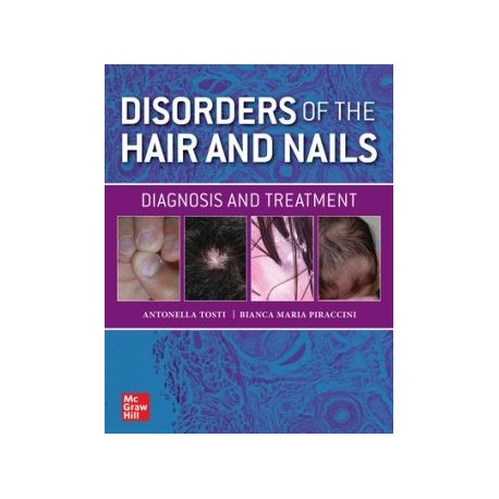 Disorders of the Hair and Nail: Diagnosis and Treatment