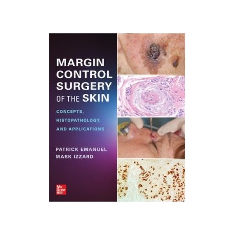 Margin Control Surgery of the Skin: Concepts, Histopathology, and Applications