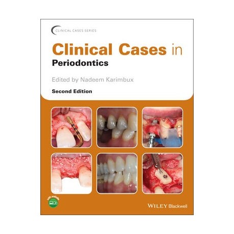 Clinical Cases in Periodontics, 2nd Edition