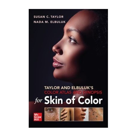 Taylor and Elbuluk`s Color Atlas and Synopsis for Skin of Color