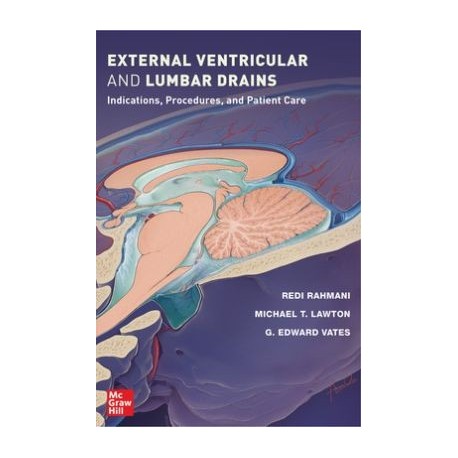 External Ventricular and Lumbar Drains: Indications, Procedures, and Patient Care