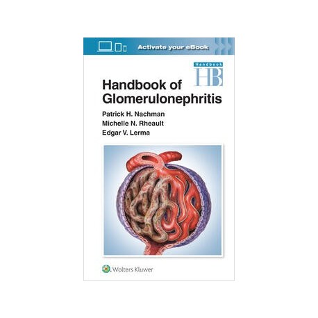 Handbook of Glomerulonephritis