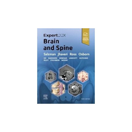 ExpertDDx: Brain and Spine, 3rd Edition