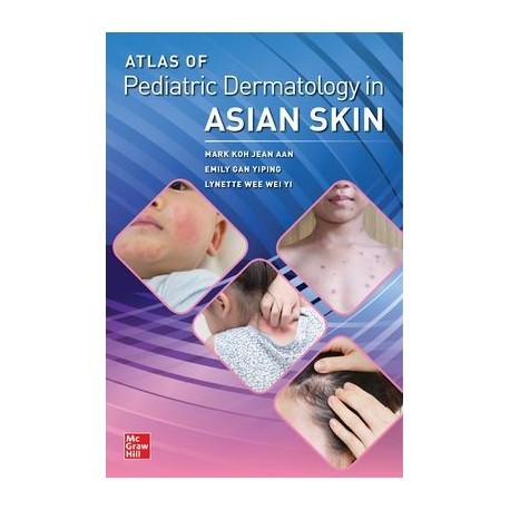 Atlas of Pediatric Dermatology in Asian Skin