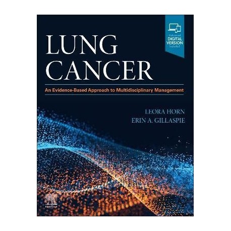 Lung Cancer An Evidence-Based Approach to Multidisciplinary Management