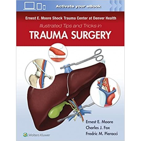 Ernest E. Moore Shock Trauma Center at Denver Health Illustrated Tips and Tricks in Trauma Surgery