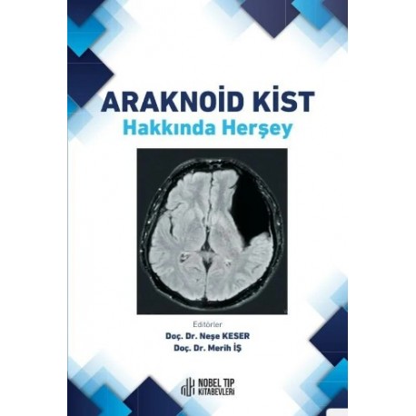 Araknoid Kist Hakkında Herşey