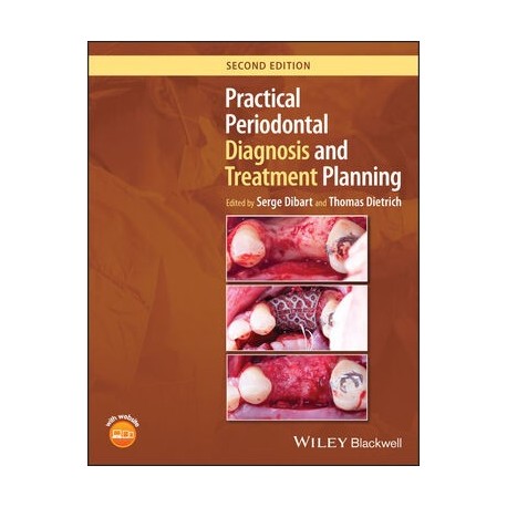 Practical Periodontal Diagnosis and Treatment Planning, 2nd Edition