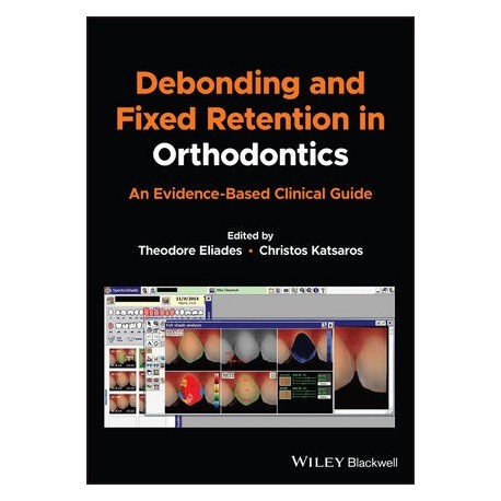 Debonding and Fixed Retention in Orthodontics: An Evidence-Based Clinical Guide