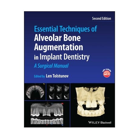 Essential Techniques of Alveolar Bone Augmentation in Implant Dentistry: A Surgical Manual, 2nd Edition