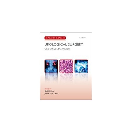 Challenging Cases in Urological Surgery