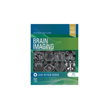 Brain Imaging: Case Review Series, 3rd Edition