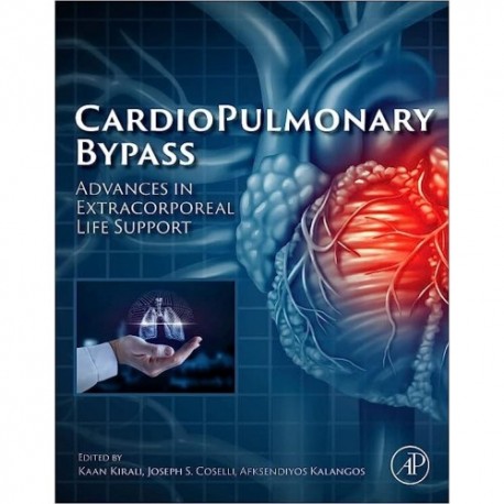 Cardiopulmonary Bypass Advances in Extracorporeal Life Support