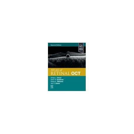 Atlas of Retinal OCT: Optical Coherence Tomography, 2nd Edition