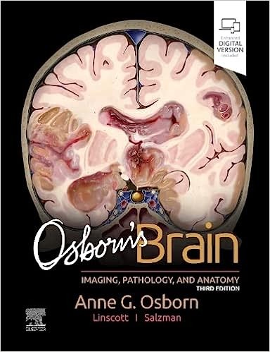 Osborn`s Brain, 3rd Edition - NOBEL Kitabevi