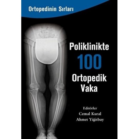 Poliklinikte 100 Ortopedik Vaka