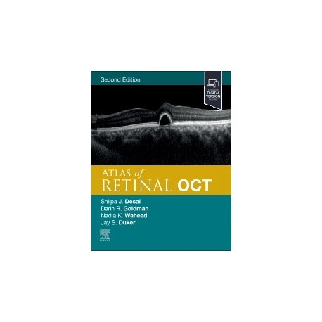 Atlas of Retinal OCT, 2nd Edition