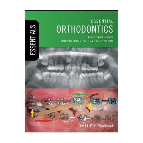 Essential Orthodontics 