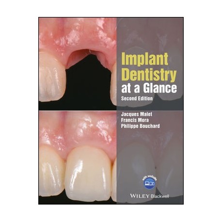 Implant Dentistry at a Glance, 2nd Edition