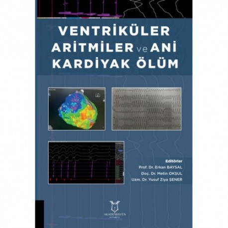 Ventriküler Aritmiler ve Ani Kardiyak Ölüm