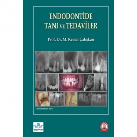 Endodontide Tanı ve Tedaviler