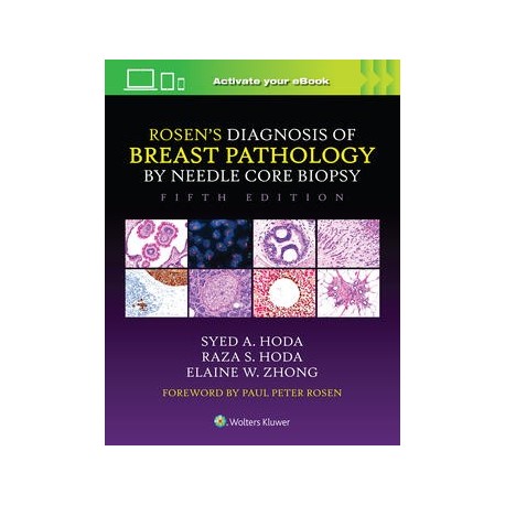 Rosen`s Diagnosis of Breast Pathology by Needle Core Biopsy