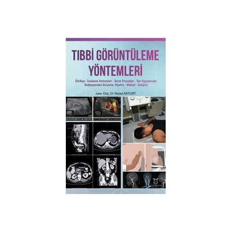 Tibbi Görüntüleme Yöntemleri