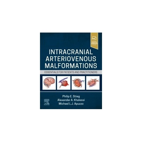 Intracranial Arteriovenous Malformations Essentials for Patients and Practitioners