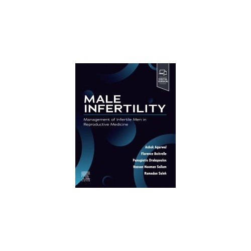 Male Infertility Management Of Infertile Men In Reproductive Medicine Nobel Kitabevi