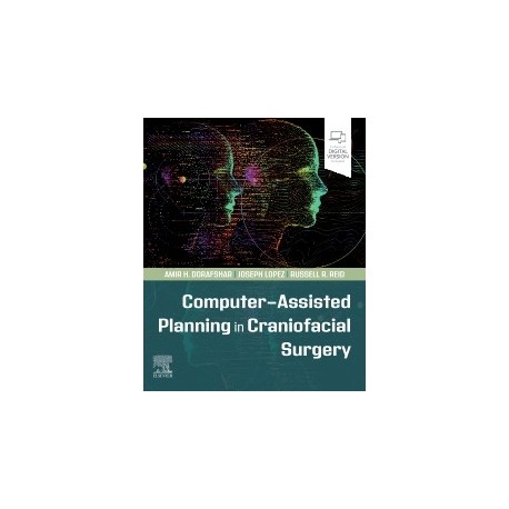 Computer-Assisted Planning in Craniofacial Surgery