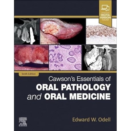 Cawson`s Essentials of Oral Pathology and Oral Medicine, 10th Edition