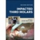 Impacted Third Molars, 2nd Edition