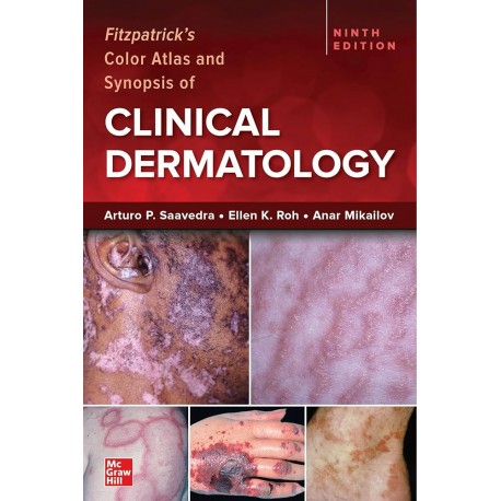 Fitzpatrick`s Color Atlas and Synopsis of Clinical Dermatology, 9th Edition