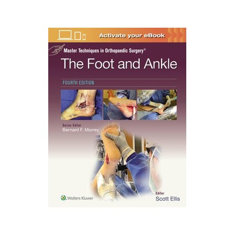 Master Techniques in Orthopaedic Surgery: The Foot and Ankle