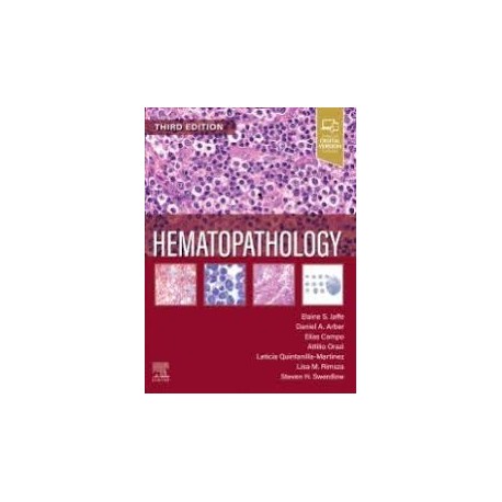 Hematopathology, 3rd Edition