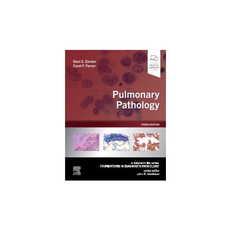 Pulmonary Pathology, 3rd Edition