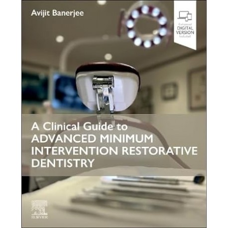 A Clinical Guide to Advanced Minimum Intervention Restorative Dentistry