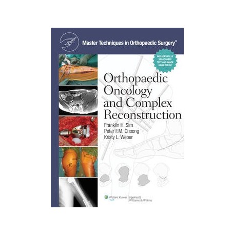 Master Techniques in Orthopaedic Surgery: Orthopaedic Oncology and Complex Reconstruction