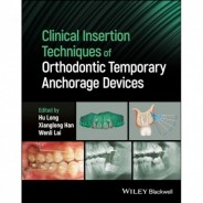 Clinical Insertion Techniques of Orthodontic Temporary Anchorage Devices