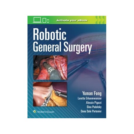 Robotic General Surgery