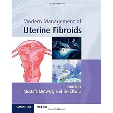 Modern Management of Uterine Fibroids