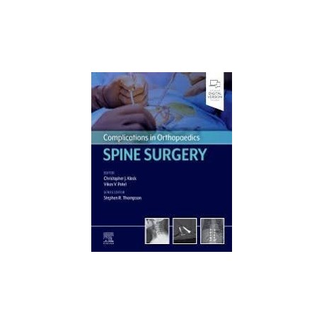 Complications in Orthopaedics: Spine Surgery