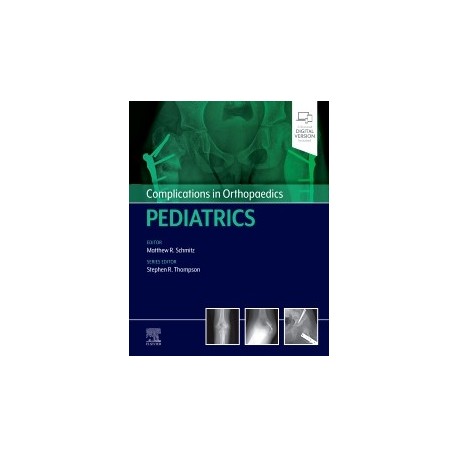 Complications in Orthopaedics: Pediatrics