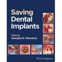 Saving Dental Implants