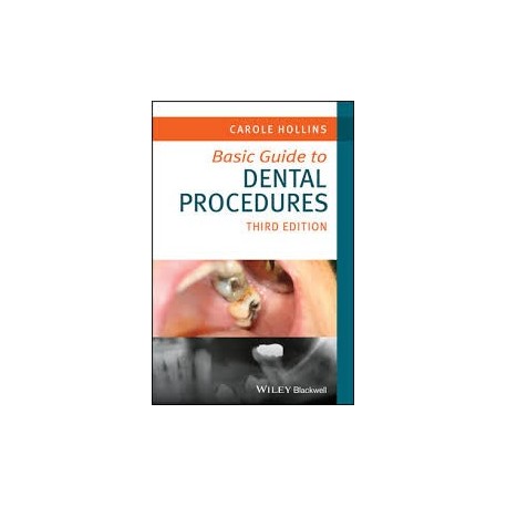 Basic Guide to Dental Procedures, 3rd Edition